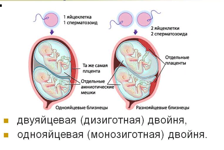 Как можно забеременеть двойней