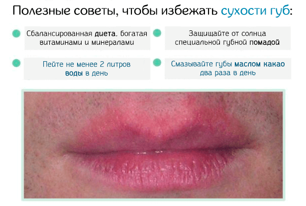 Почему трескаются губы в уголках рта? способы лечения