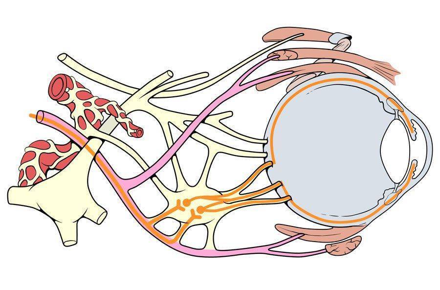 Дистрофия зрительного нерва глаукома есть ли шанс вылечиться thumbnail