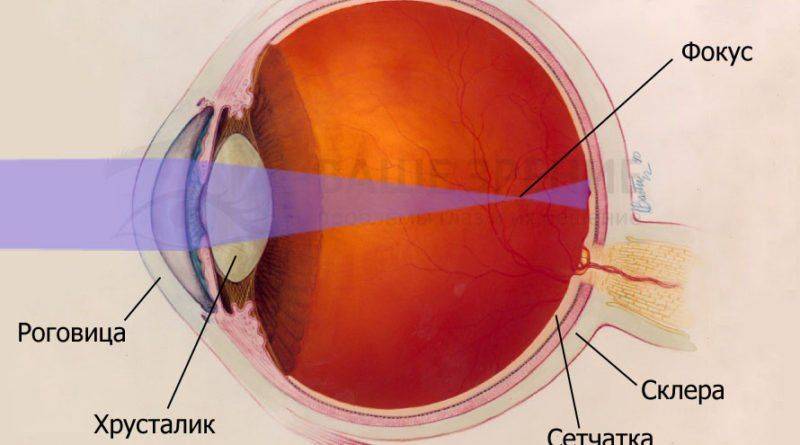 Зрение при миопии