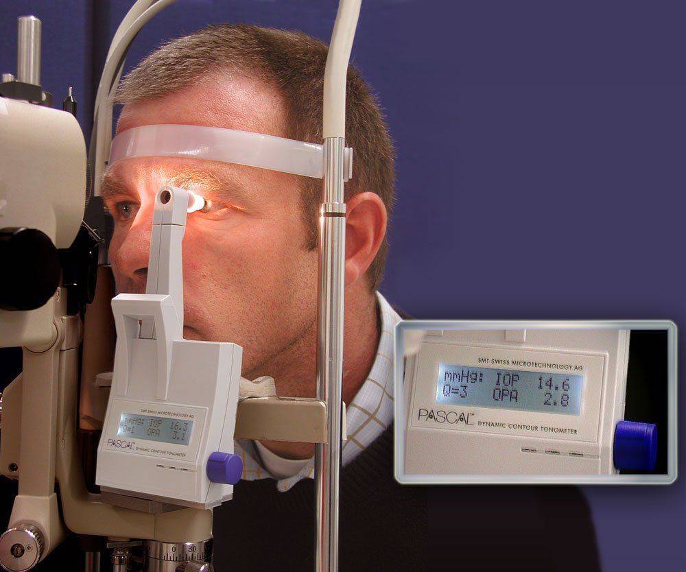 Диагностика глаукомы: тонометрия